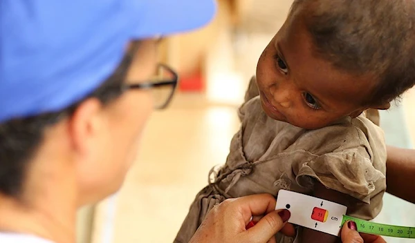 Food insecurity threatens thousands of children in southern Madagascar