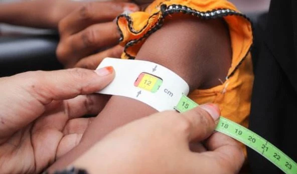 Unicef Report: Most Children in Developed Countries are Malnourished