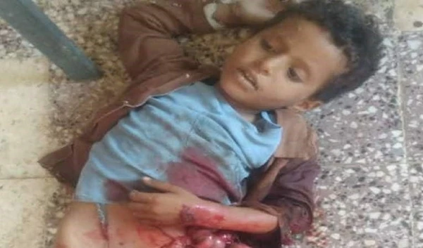 8 year-old child killed in Taiz by aggression's sniper.