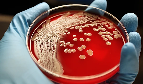 Superbug explosions (University of Sheffield)