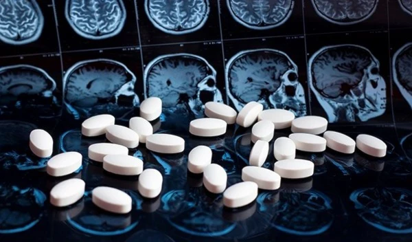 Probe: Alzheimer’s drug approval ‘rife with irregularities’