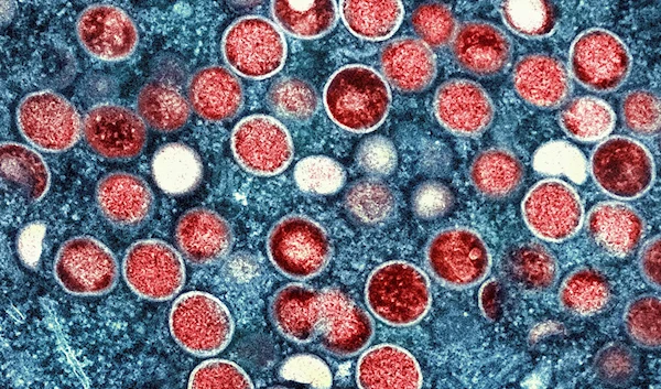 This image provided by the National Institute of Allergy and Infectious Diseases (NIAID) shows a colorized transmission electron micrograph of monkeypox particles (red) found within an infected cell (blue) (NIAID via AP, File)