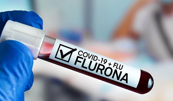 flu rowna