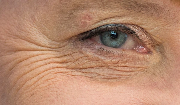 The eye of German Chancellor Angela Merkel is seen during a press conference in Berlin, Germany, Friday, July 19, 2013. (AP)