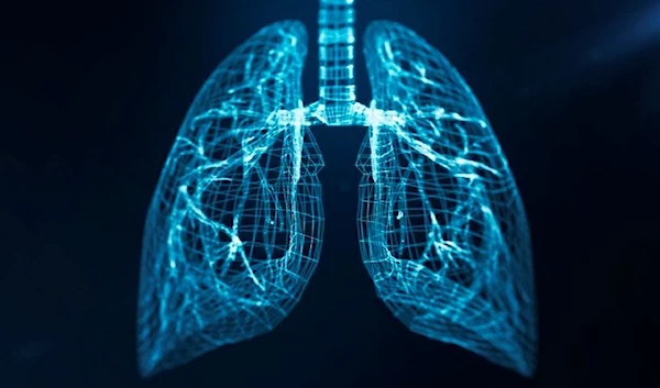 AI tool to predict lung cancer. (Getty Images)