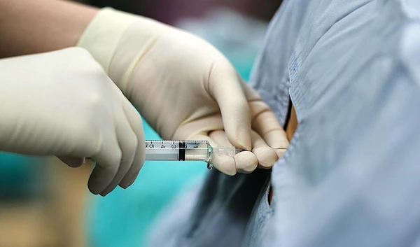 A doctor using an anesthetic epidural (Hospital for Special Surgery)