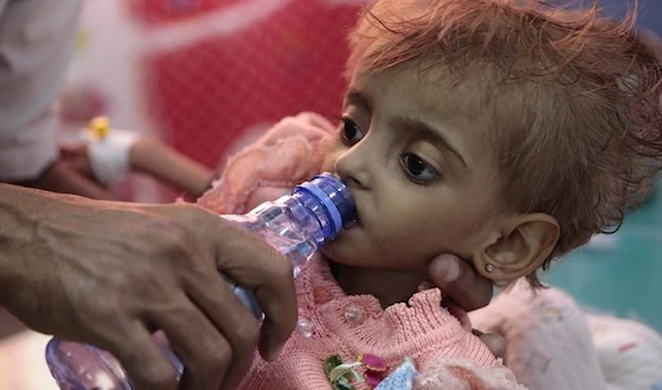 In this Thursday, Sept. 27, 2018, file photo, a father gives water to his malnourished daughter at a feeding center in a hospital in Al Hudaydah, Yemen. (AP)