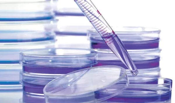 Petri dishes are pictured in an unknown location in a Cancer Research UK laboratory on an unknown date. (Reuters)