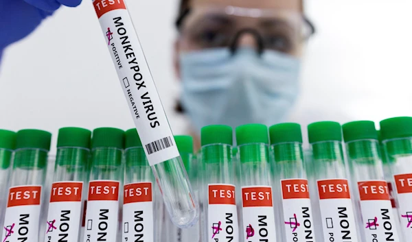 Test tubes labelled "Monkeypox virus positive" in a lab on May 23, 2022 (Reuters)