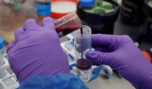 New blood biomarker can predict Alzheimer's disease