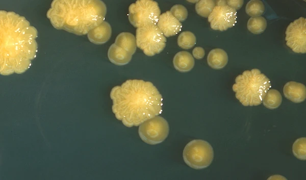 This photo provided by the Centers for Disease Control and Prevention shows Cronobacter sakazakii bacteria colonies in a petri dish in 1978 (AP)