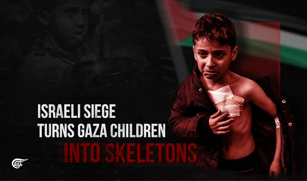 Israeli siege turns Gaza children into skeletons