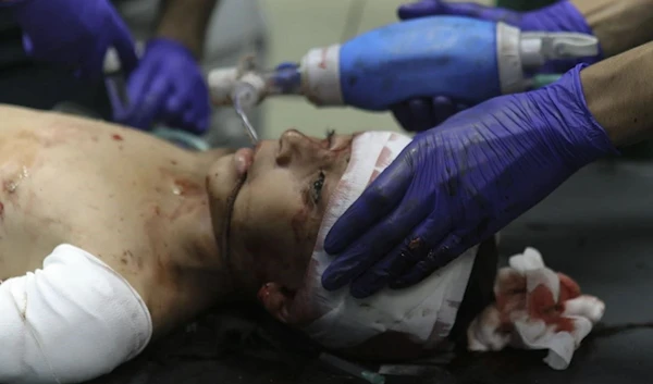 A wounded Palestinian child receives medical treatment at Nasser hospital following Israeli bombing on Khan Younis refugee camp on November 20,2023. (AP)