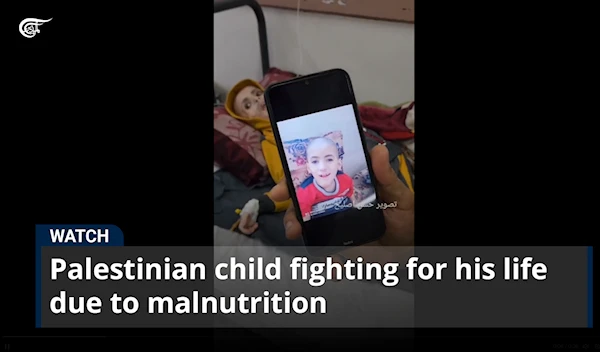 Palestinian child fighting for his life due to malnutrition