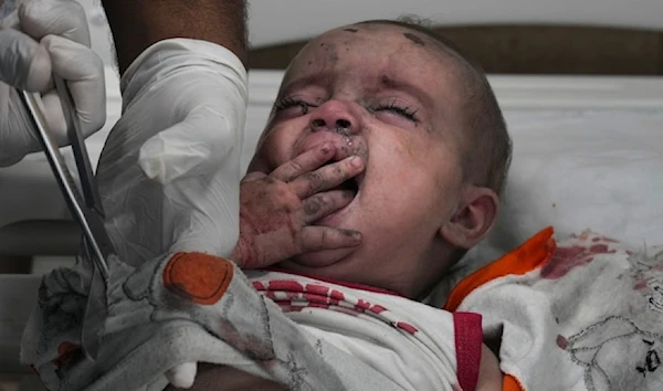 Palestinian child wounded in Israeli airstrike on his home is treated in a hospital in Deir al-Balah, south of the Gaza Strip, on October 27, 2023. (AP)