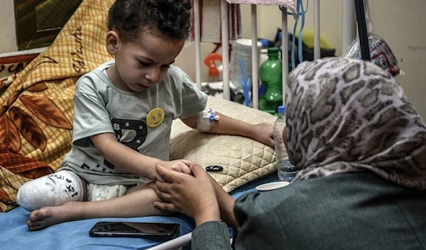 Abed Zaqout is a 3-year-old boy, whose house was bombed, recovering in Nasser hospital after the amputation of part of his right leg on December 2023. (UNICEF)