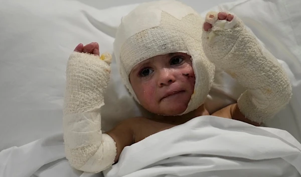 Ivana Skakye, 2, a Lebanese child with third-degree burns from an Israeli airstrike last September near Deir Qanoun al Nahr, raises her burned arms in a hospital bed in Beirut on Oct. 29, 2024. (AP)