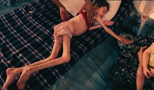 A Palestinian girl lies weak and disoriented on a mattress in Gaza, drifting in and out of sleep from severe malnutrition and dehydration, her small ribcage visible beneath a loose red T-shirt. (