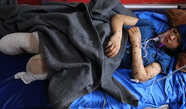 A 13-year-old Palestinian amputee  as a result of an Israeli airstrike at Al-Nasr Hospital in Khan Younis, Gaza, in October. (Agence France-Presse — Getty Images)