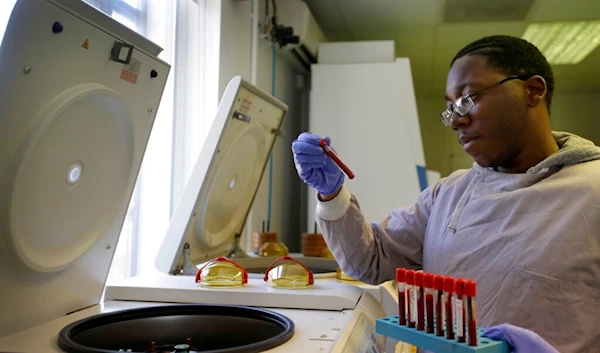 Leon McFarlane a research technician uses a centrifuge on blood samples from volunteers in the laboratory at Imperial College in London, Thursday, July 30, 2020. (AP)