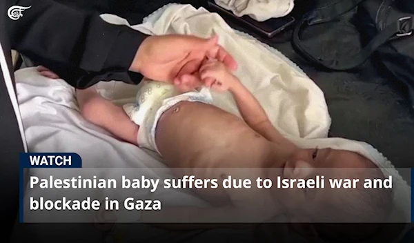 Palestinian baby suffers due to Israeli war and blockade in Gaza