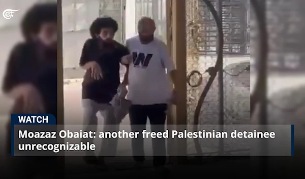 Moazaz Obaiat: Another freed Palestinian detainee unrecognizable