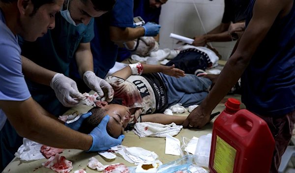 A Palestinian boy wounded in the Israeli bombardment of the Gaza Strip is treated in a hospital in Khan Younis, Tuesday, July 9, 2024. (AP)