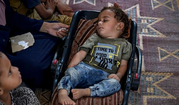 Displaced infant Abdel-Rahman Abu El-Jedian, who suffers from polio, sleeps at a makeshift tent camp in Deir al-Balah, central Gaza Strip, Palestine, Aug. 27, 2024. (AP)