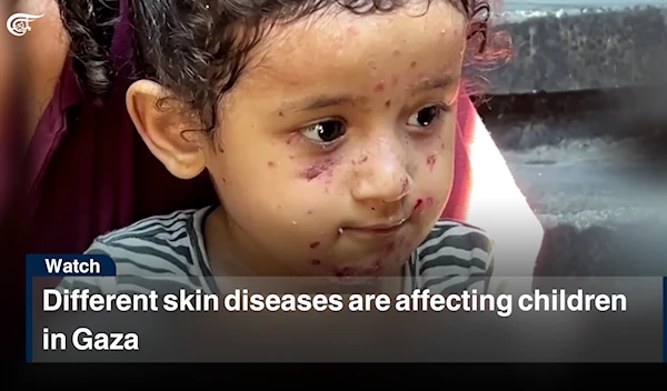 Different skin diseases are affecting children in Gaza