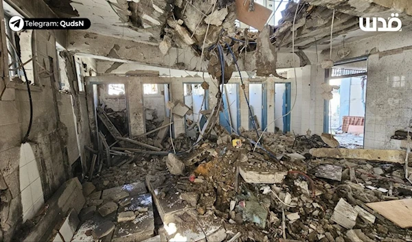 The aftermath of the Israeli bombardment of a school sheltering displaced Palestinians in the Al-Zeitoun neighborhood