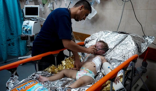 Palestinian Child Siwar Abdel-Hadi, 2, wounded in the Israeli bombardment of the Gaza Strip, receives medical treatment at a hospital in Deir al-Balah, Wednesday, July 24, 2024. (AP)